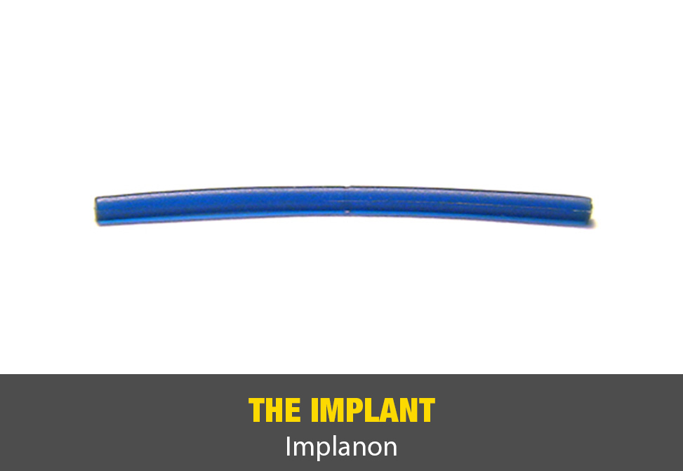 The Implant (Implanon)