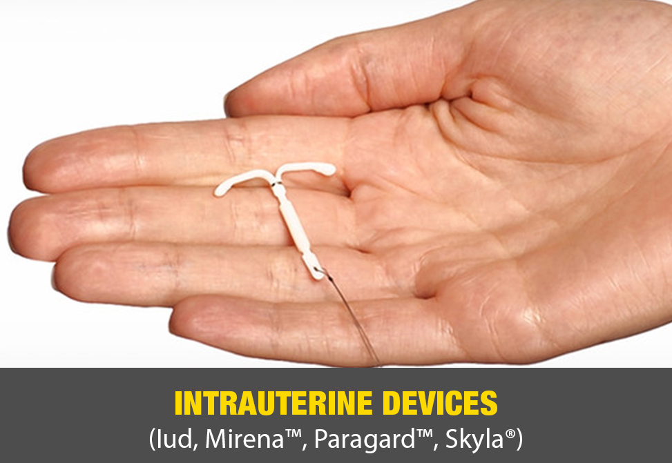 Intrauterine Devices (IID, Mirena™, Paragard™, Skyla®)